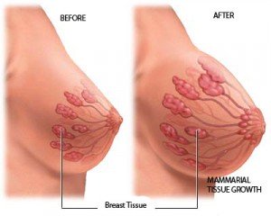 breast-lacta